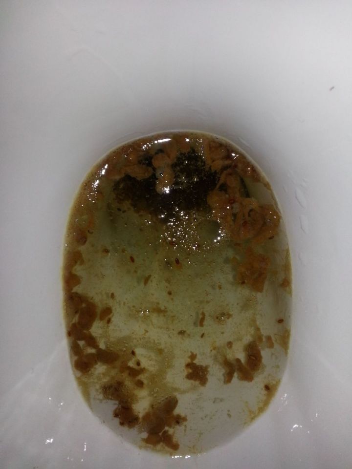 Candida in stool? On CureZone File Storage