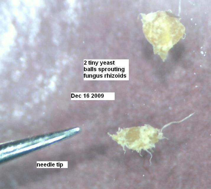 Image: 2 yeast balls sprout fungal filaments/ with needletip Image: 2 yeast balls sprout fungal filaments/ with needletip