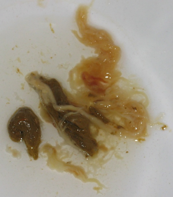 //www.curezone.org/upload/_C_Forums/Candida/Poop/what_is_this.jpg