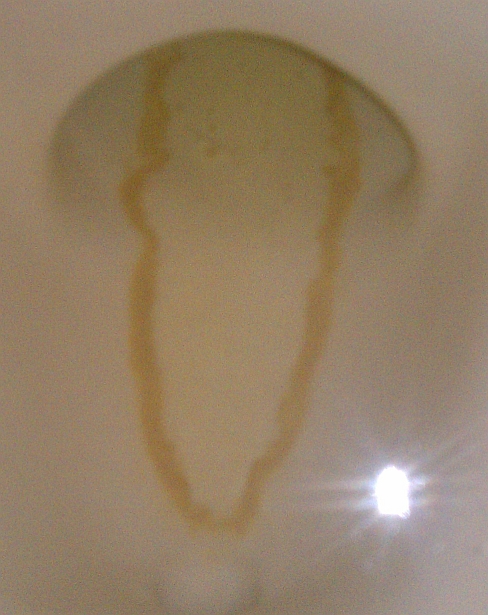 //www.curezone.org/upload/_C_Forums/Candida/c11.jpg