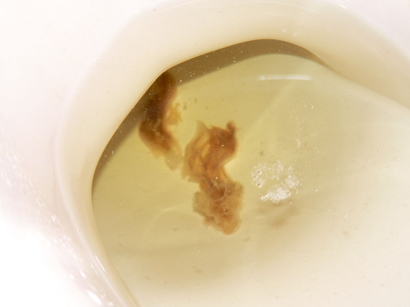 //www.curezone.org/upload/_C_Forums/Candida/candida01.jpg