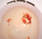 Enema blood ... (Click to enlarge)