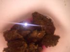 What is this in my stool?