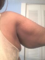obese