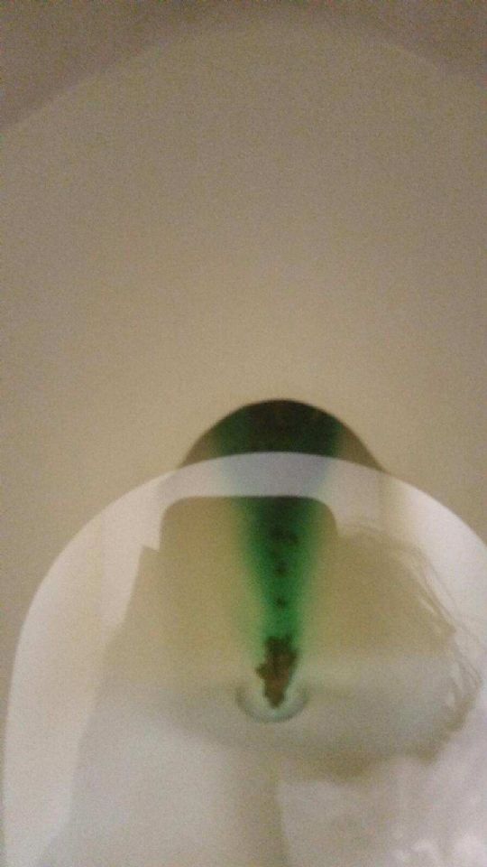Image: Bowel movement is brown but it made the water by the poop this strange blue color Image: Bowel movement is brown but it made the water by the poop this strange blue color