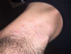 IMG 4501