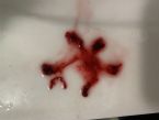 worm star? abnormal uterine bleeding worms ... (Click to enlarge)