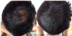 Brosta Hair - 30 Seconds Change
