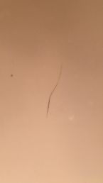 Worms that look like hair