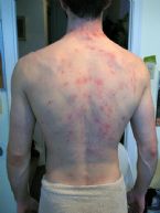Back