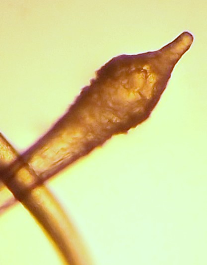//www.curezone.org/upload/_M_Forums/Morgellons/0282.jpg