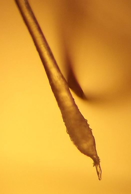 //www.curezone.org/upload/_M_Forums/Morgellons/0631.jpg