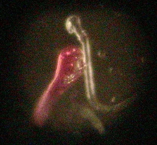 //www.curezone.org/upload/_M_Forums/Morgellons/0661.jpg