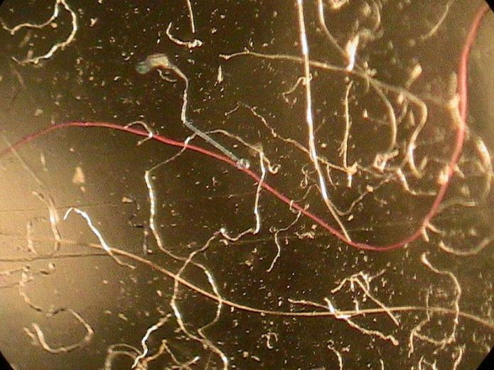 //www.curezone.org/upload/_M_Forums/Morgellons/081.jpg