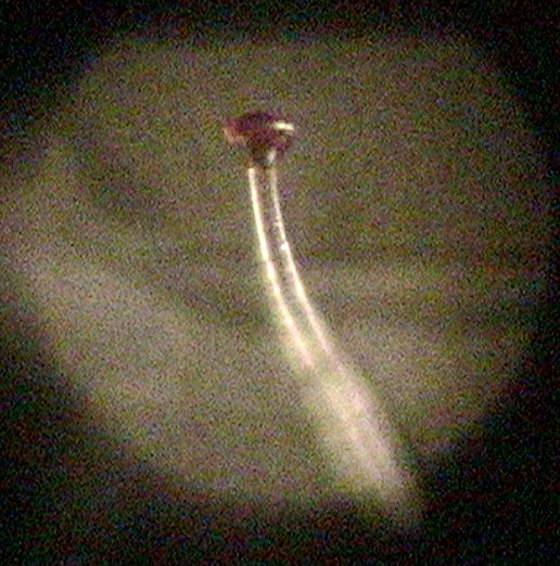 //www.curezone.org/upload/_M_Forums/Morgellons/091.jpg
