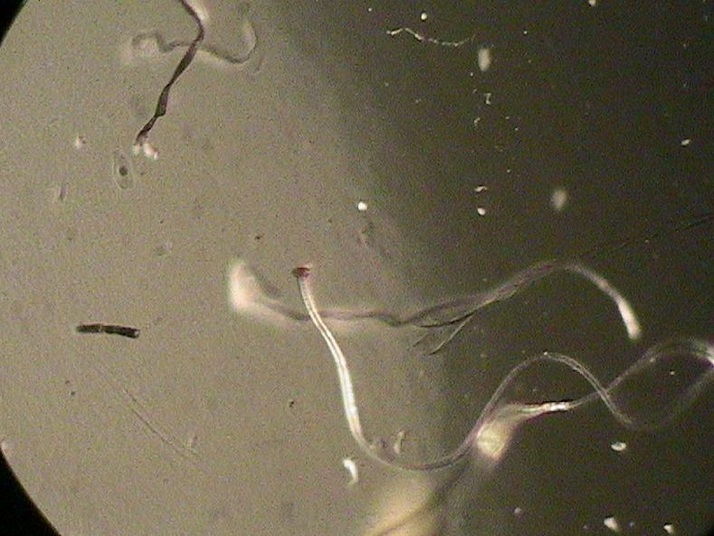 //www.curezone.org/upload/_M_Forums/Morgellons/095.jpg