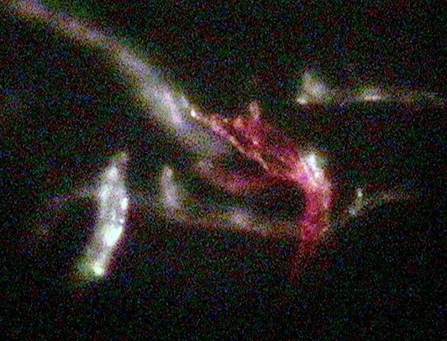 //www.curezone.org/upload/_M_Forums/Morgellons/140.jpg