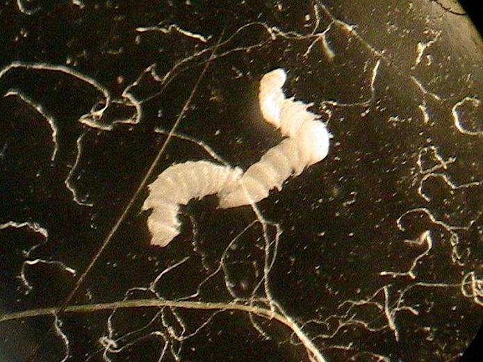 //www.curezone.org/upload/_M_Forums/Morgellons/146.jpg