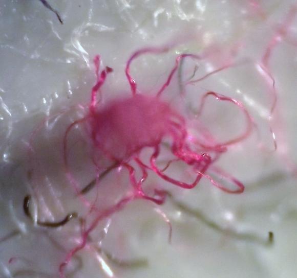 //www.curezone.org/upload/_M_Forums/Morgellons/215.jpg