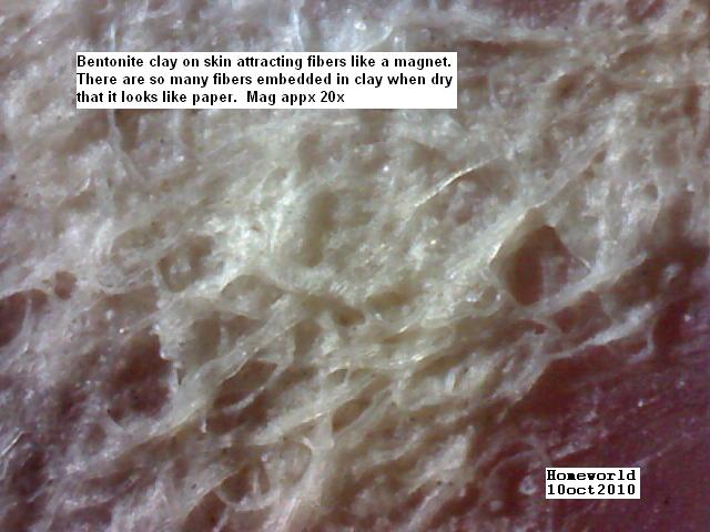 //www.curezone.org/upload/_M_Forums/Morgellons/FHW/Skin/clayfibers10oct10.jpg