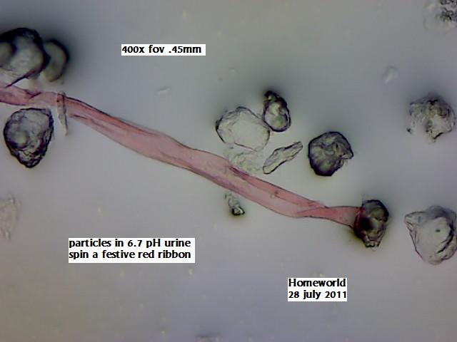 //www.curezone.org/upload/_M_Forums/Morgellons/FHW/Urine/redribbon28jul11.jpg