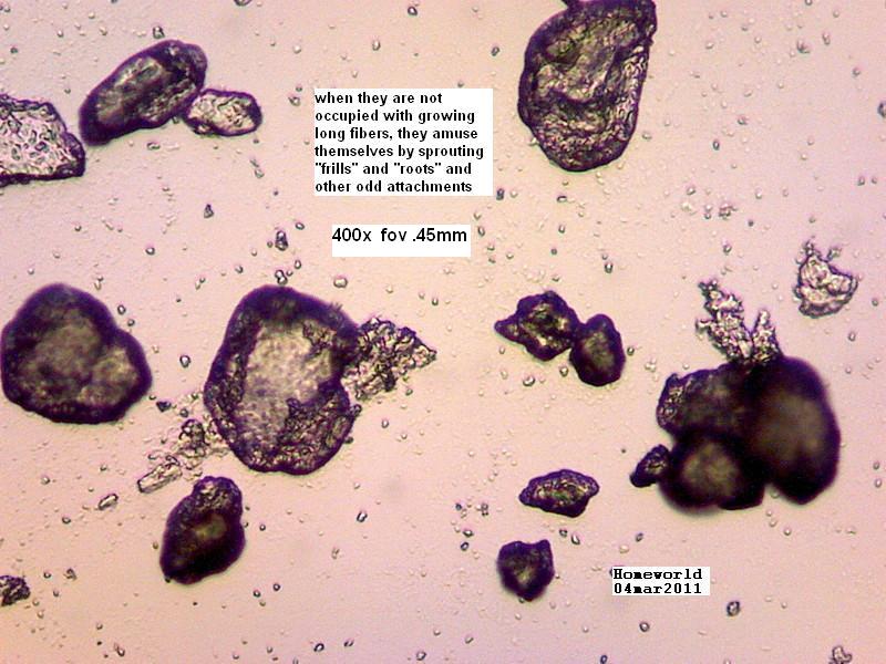 //www.curezone.org/upload/_M_Forums/Morgellons/FHW/Urine/urine_particl/Copy_of_3.jpg