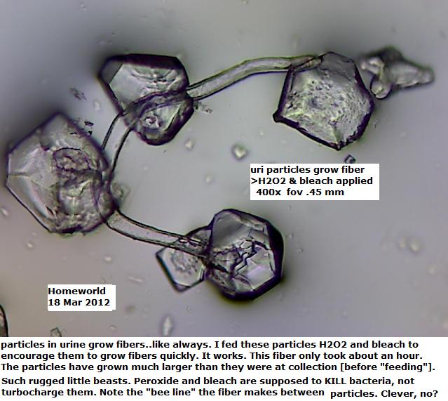 //www.curezone.org/upload/_M_Forums/Morgellons/FHW/Urine/uripart18mar12.jpg