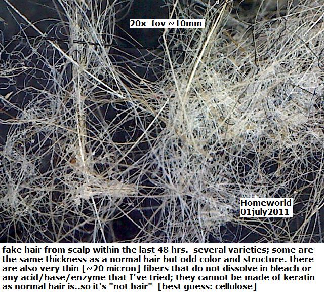 //www.curezone.org/upload/_M_Forums/Morgellons/FHW/hair_and_scalp/fauxhair1jul11.jpg
