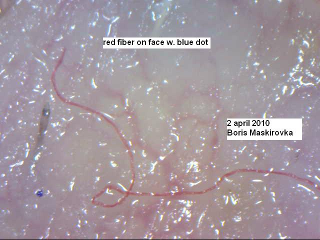 Image: red fiber on face 2 apr 2010 Image: red fiber on face 2 apr 2010