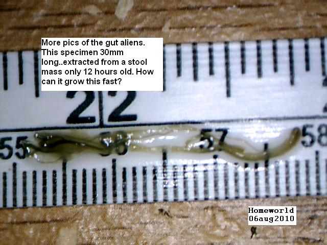 //www.curezone.org/upload/_M_Forums/Morgellons/FHW/stool/alienlong6axug10.jpg