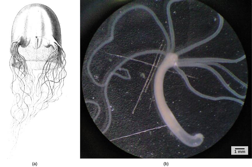 //www.curezone.org/upload/_M_Forums/Morgellons/Figure_15_02_07ab.jpg