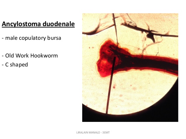 //www.curezone.org/upload/_M_Forums/Morgellons/nematodes_19_638.jpg
