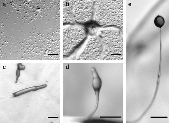 //www.curezone.org/upload/_M_Forums/Morgellons/nprot_2007_178_F3.jpg
