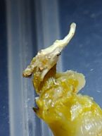 Acanthocephala or Rotifer ... (Click to enlarge)