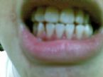 lucifiel teeth1