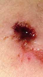 Is this a parasite?