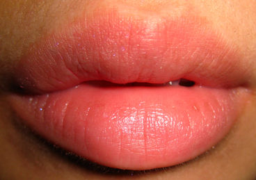 //www.curezone.org/upload/_O_P_Forums/Peeling_Lips/naturallips.jpg
