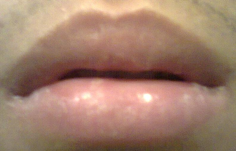 //www.curezone.org/upload/_O_P_Forums/Peeling_Lips/smooth.jpg