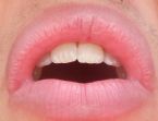 1/3 top lip ... (Click to enlarge)