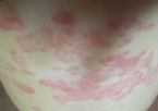 p on stomach december2016