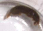 unknown parasite found in stool_1 ... (Click to enlarge)