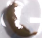 unknown parasite found in stool ... (Click to enlarge)