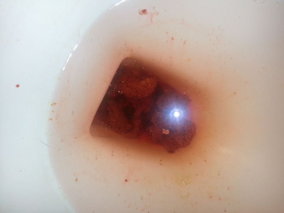 //www.curezone.org/upload/_S_Forums/Symptoms/20130402_003343.jpg