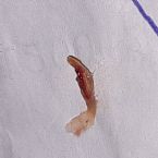 What is this from skin ... (Click to enlarge)