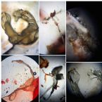 Unidentified Skin Parasite Specimens Flat Worm Threadworm Morgellons Pods WHAT ARE THESE? Microscopic Photos May/June 2018 ... (Click to enlarge)