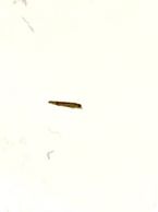 From facial skin ... (Click to enlarge)