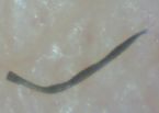 blue worm strongyloides ... (Click to enlarge)