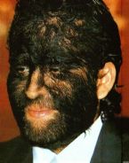 hairy face collar ... (Click to enlarge)
