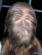 hairy face danish ... (Click to enlarge)