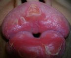 after 10 days - picture taken when I wake up (white stuff) ... (Click to enlarge)